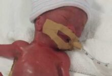 Минута отдыха Самый маленький ребенок в мире благополучно выписан из больницы (3 фото) Дети 