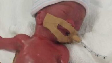 Минута отдыха Самый маленький ребенок в мире благополучно выписан из больницы (3 фото) Дети  Минута отдыха Самый маленький ребенок в мире благополучно выписан из больницы (3 фото) Дети