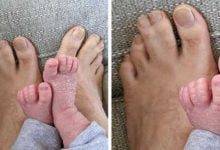 Минута отдыха 15 живых существ, которые отличаются от всех остальных, и в этом их сила Интересное 