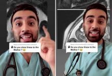 Минута отдыха Врач назвал причину, по которой они всегда отказываются показывать беременным девушкам снимки мрт (4 фото) Дети 