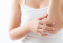 Минута отдыха Как появляется шершавость на локте, придавая рукам некрасивый вид Интересное 