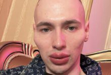 Минута отдыха «Очень красивый самец». Фейковый культурист лёг под нож, чтобы стать инопланетянином Спорт 