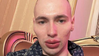 Минута отдыха «Очень красивый самец». Фейковый культурист лёг под нож, чтобы стать инопланетянином Спорт  Минута отдыха «Очень красивый самец». Фейковый культурист лёг под нож, чтобы стать инопланетянином Спорт