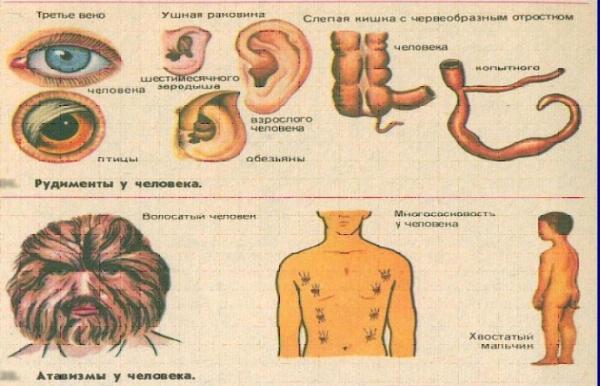         Какие органы у человека "лишние"    