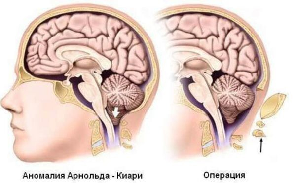 Минута отдыха 10 странных медицинских состояний, которых определённо стоит опасаться Интересное  