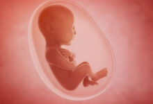 Минута отдыха Что такое литопедион? И может ли младенец остаться в животе матери? Интересное 