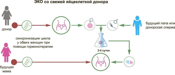 Минута отдыха Когда и зачем проводят ЭКО с донорскими яйцеклетками Полезности  