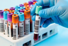 Минута отдыха Ты уверен, что здоров? Список анализов, которые нужно сдать до 40, 50 и 60 лет Интересное 