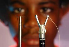 Минута отдыха 14-летний подросток разработал собственную хирургическую технику Дети 