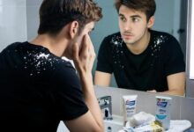 Минута отдыха Перхоть – не только про возраст и косметику Полезности эксклюзив перхоть Игорь Михайлов здоровье 