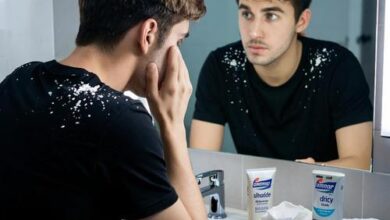 Минута отдыха Перхоть – не только про возраст и косметику Полезности эксклюзив перхоть Игорь Михайлов здоровье 