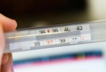 Минута отдыха Инфекционист Дондурей: скарлатину вызывает стрептококк группы А Полезности температура сосуды скарлатина подростки бред 